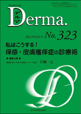 私はこうする!痒疹.皮膚ソウ痒症の診療術