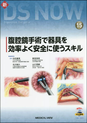 腹腔鏡手術で器具を效率よく安全に使うスキ