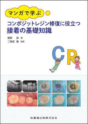 コンポジットレジン修復に役立つ接着の基礎