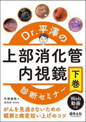 Dr.平澤の上部消化管內視鏡診斷セミ 下