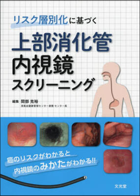 上部消化管內視鏡スクリ-ニング