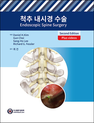 척추 내시경 수술