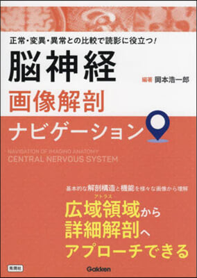 腦神經畵像解剖ナビゲ-ション