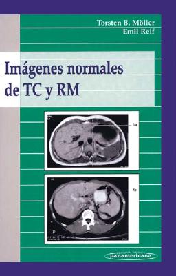 Imagenes normales de TC y RM / Normal Images of CT and MRI