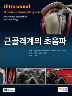 근골격계의 초음파