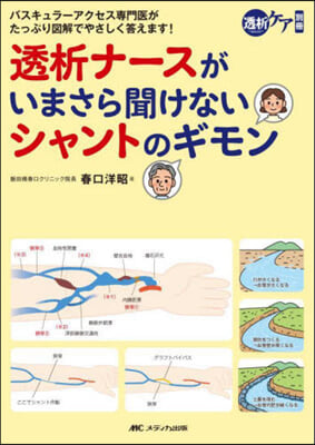 透析ナ-スがいまさら聞けないシャントのギモン 