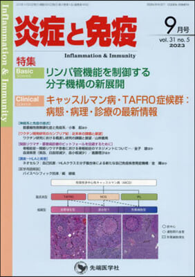 炎症と免疫 31－5