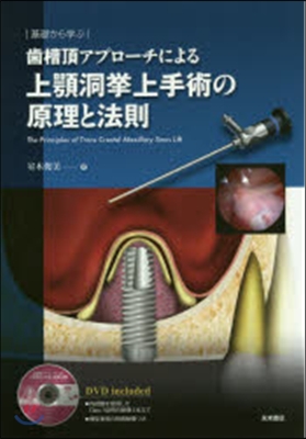 基礎から學ぶ 齒槽頂アプロ-チによる上顎洞擧上手術の原理と法則