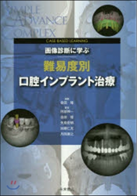 畵像診斷に學ぶ難易度別口腔インプラント治