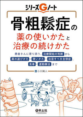 骨粗?症の藥の使いかたと治療の續けかた