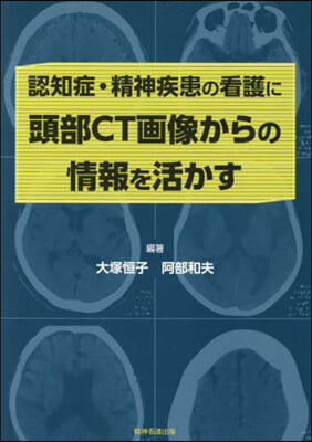 認知症.精神疾患の看護に頭部CT畵像から