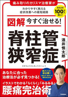 圖解 今すぐ治せる!脊柱管狹窄症