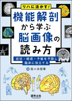 機能解剖から學ぶ腦畵像の讀み方