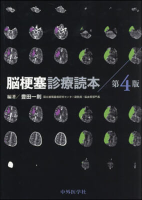 腦梗塞診療讀本 第4版