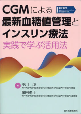 CGMによる最新血糖値管理とインスリン療