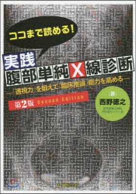 ココまで讀める!實踐腹部單純X線診 2版