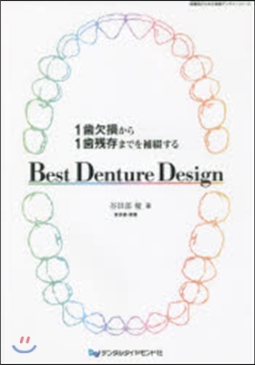 Best Denture Design