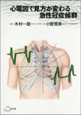 心電圖で見方が變わる急性冠症候群