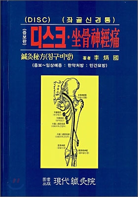 디스크 좌골신경통 침구비방