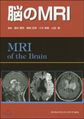 腦のMRI