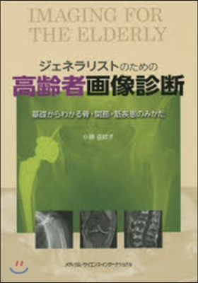 ジェネラリストのための高齡者畵像診斷