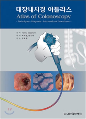 대장내시경아틀라스
