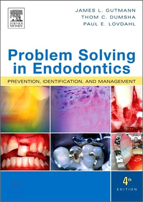 Problem Solving in Endodontics