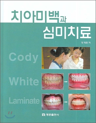 치아미백과 심미치료