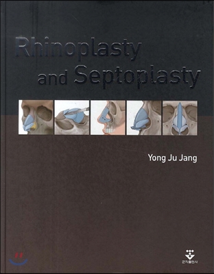 Rhinoplasty and Septoplasty (영문판)