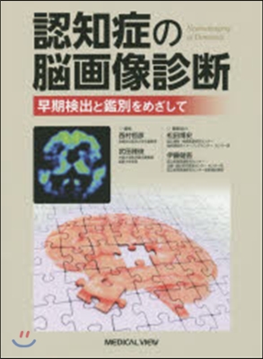 認知症の腦畵像診斷 早期檢出と鑑別をめざ