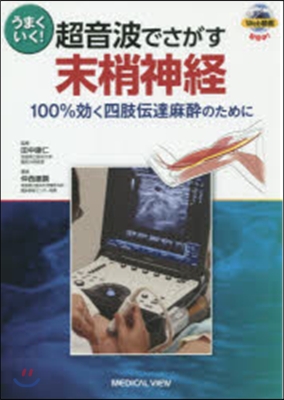 うまくいく!超音波で探す末梢神經