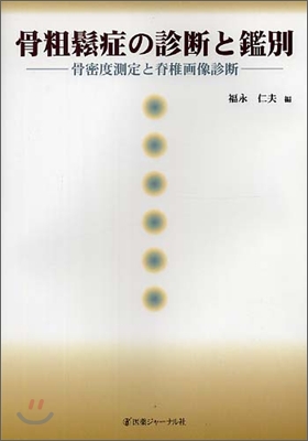 骨粗松症の診斷と鑑別