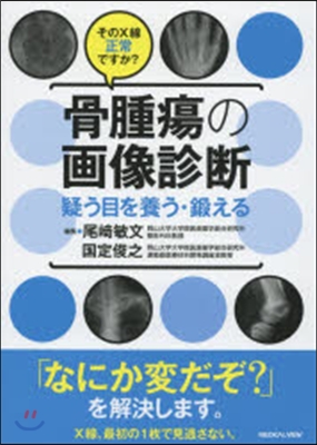 そのX線正常ですか? 骨腫瘍の畵像診斷