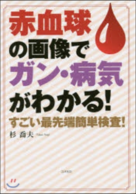 赤血球の畵像でガン.病氣がわかる!