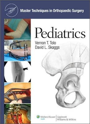 Master Techniques in Orthopaedic Surgery : Pediatrics