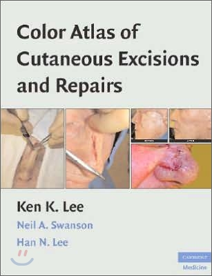 Color Atlas of Cutaneous Excisions and Repairs