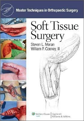 Master Techniques in Orthopaedic Surgery : Soft Tissue Surgery