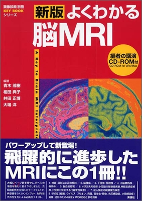 よくわかる 腦MRI 第2版