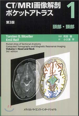 CT/MRI畵像解剖ポケットアトラス(1)頭部/頸部