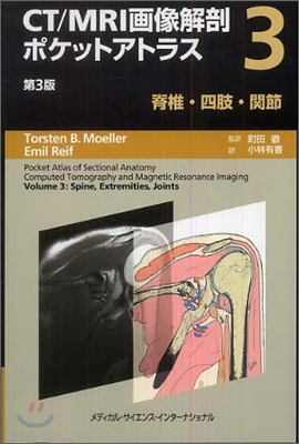 CT/MRI畵像解剖ポケットアトラス(3)脊椎/四肢/關節