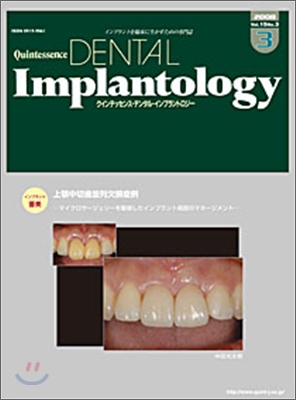 [정기구독]Quintessence DENTAL IMPLANTOLOGY(격월간)