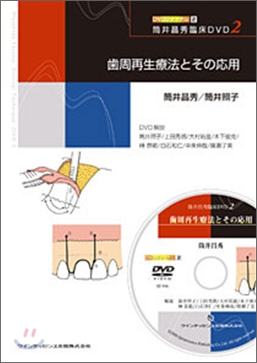 筒井昌秀臨床DVD2 齒周再生療法とその應用