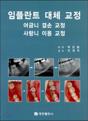 임플란트 대체 교정 