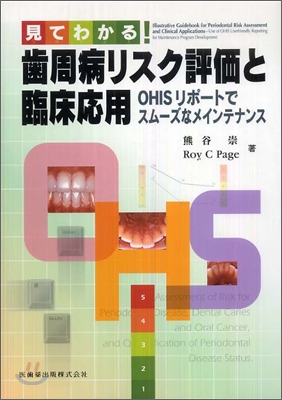 見てわかる!齒周病リスク評家と臨床應用