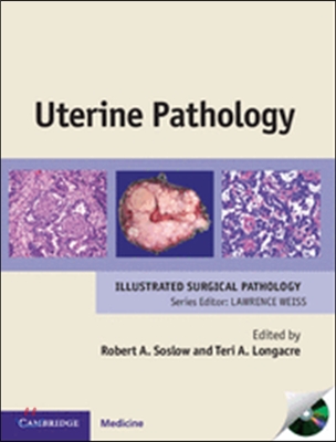 Uterine Pathology