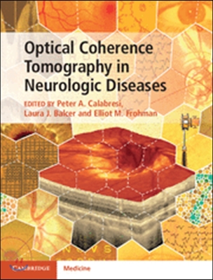 Optical Coherence Tomography in Neurologic Diseases