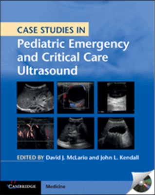 Case Studies in Pediatric Emergency and Critical Care Ultrasound with DVD-ROM [With DVD ROM]