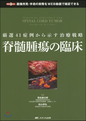 脊髓腫瘍の臨床－嚴選41症例から示す治療