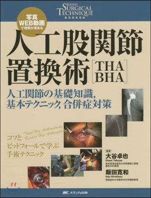 人工股關節置換術［THA.BHA］