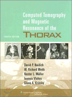 Computed Tomography and Magnetic Resonance of the Thorax, 4/E